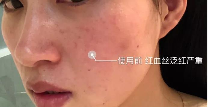 包邊燒烤網250x250mm方形